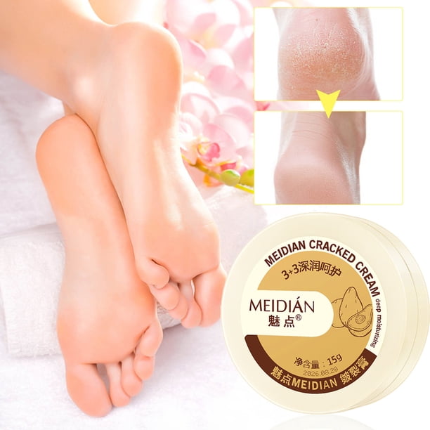 Fiudx Crema para Grietas, Crema Hidratante Intensa para Manos y Pies, Fórmula Exfoliante Suave de Tortuga, Bálsamo Reparador Enriquecido con Urea, Protección para Piel Seca, Esencial para Cuidado Inv