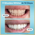 thumbnail image 2 of Lumineux Enamel-Safe & Peroxide-Free Teeth Whitening Strips, Dentist Formulated, 14-Pack, 2 of 9