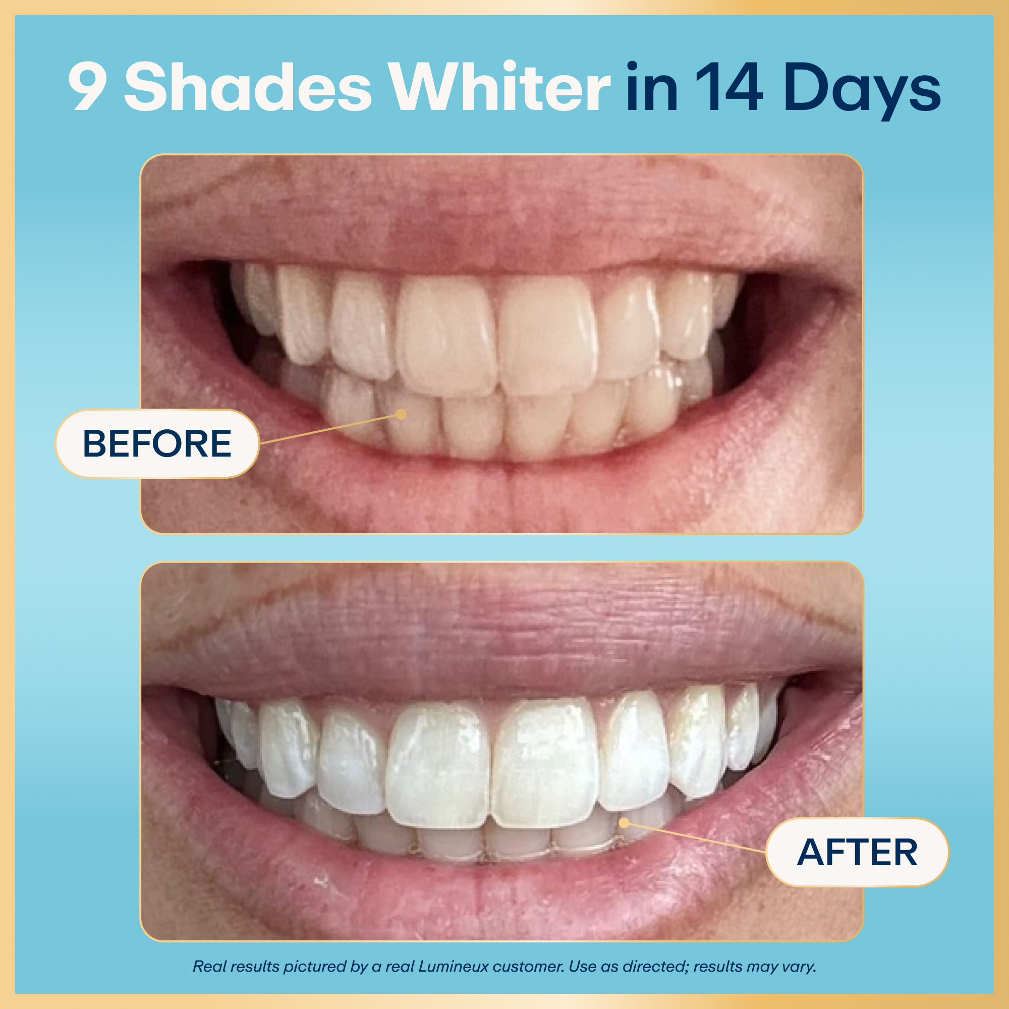 Lumineux Enamel-Safe Teeth Whitening Strips, 14-Pack photo 2