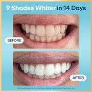 Lumineux Teeth Whitening & Dual Action Stain Repellant Bright, Peroxide Free & Enamel Safe, 1 Pen