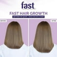 thumbnail image 2 of Nisim Normal to Oily Shampoo 2 oz, 2 of 4
