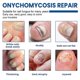 thumbnail image 3 of 60pcs Toenail Fungus Treatment Stickers Ingrowning Toenail Nail Repair Patch, 3 of 5