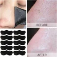 thumbnail image 2 of Mascarilla Unisex para quitar espinillas, tiras nasales, Limpieza Profunda, retráctil de poros, pegatinas negras para el cuidado de la piel, 2 of 5