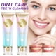thumbnail image 2 of Clearance Pasta de dientes Blanqueamiento de dientes Pasta de dientes iluminadora con niacinamida para limpiar manchas bucales Eliminación de manchas de dientes Pasta de dientes pa(Buy 2 Save 10%), 2 of 9