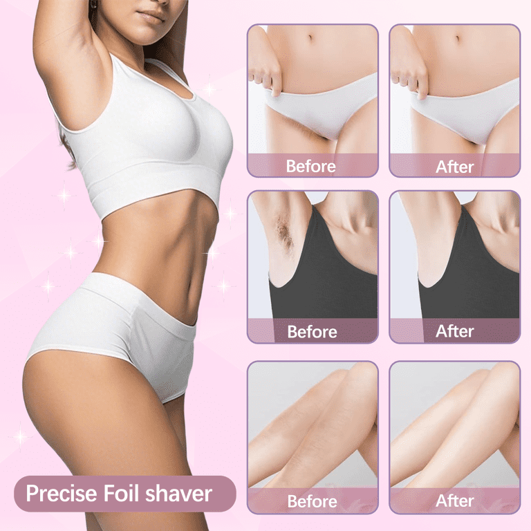Amybaby Women's 2-in-1 Electric Bikini & Body Trimmer - Painless