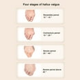 thumbnail image 3 of Bunion Toe Straightener, Professional PU Pad Adjustable Bunion Corrector  for Day Night, 3 of 8