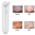 thumbnail image 4 of Blackhead Vacuum Cleaner Multi-functional Electric Blackhead Extractor, 4 of 7