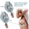 thumbnail image 3 of Lube Applicator Syringes, Lubricant Tube Shooter With Smooth Rounded Cap For Men, Women & Couples, Reusable, Easy Use & Clean [10ml Scales][gray & Gra, 3 of 4