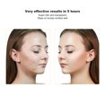 thumbnail image 3 of Crema para espinillas faciales 30 g Crema para manchas de espinillas 2 piezas Reduce el enrojecimiento para adolescentes para Zits ANGGREK Otros, 3 of 8