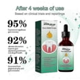thumbnail image 5 of Gotas de suero reparador de encías rápidamente para aliviar la retracción de las encías, el cuidado de las ampollas periodontales, blanquear los dientes y eliminar el dolor de muelas amarillas, pasta, 5 of 5