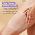 thumbnail image 4 of Crema Corporal Strivectin Kp Care Para Piel Irritada y Roja, 4 of 4