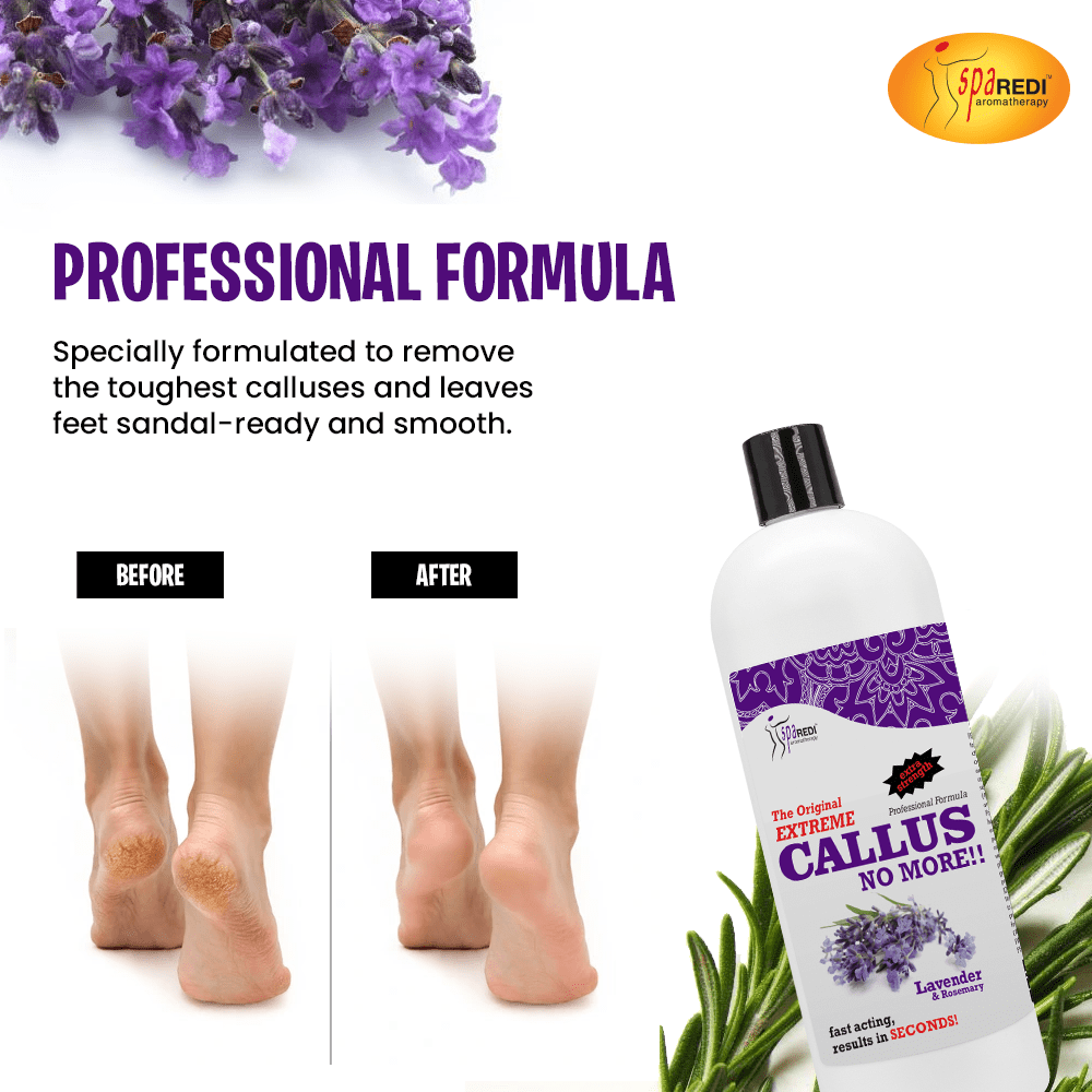 SPA REDI Callus Remover - Removes Toughest Calluses in Seconds and Smooths Dry Cracked Heels, Softens and Smooths Feet, Lavender & Rosemary - 32 Oz
