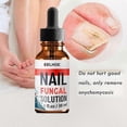 thumbnail image 2 of Nail Fungal Treatment and Repair Solution for Fingernails and Toenails, 1-3 Pieces, 2 of 5