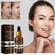 thumbnail image 2 of 1-3PCS Bee Venom Face Care Serum Anti-Aging Facial Serum Anti-Wrinkle Moisturizing Essence Beauty for Women 15ml, 2 of 5