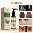 thumbnail image 3 of Organic Castor Oil With Rosemary Oil For Hair Growth - Rosemary Castor Hair Oil For Stronger, Fuller and Thicker Hair - Scalp & Hair Strengthening & V, 3 of 5