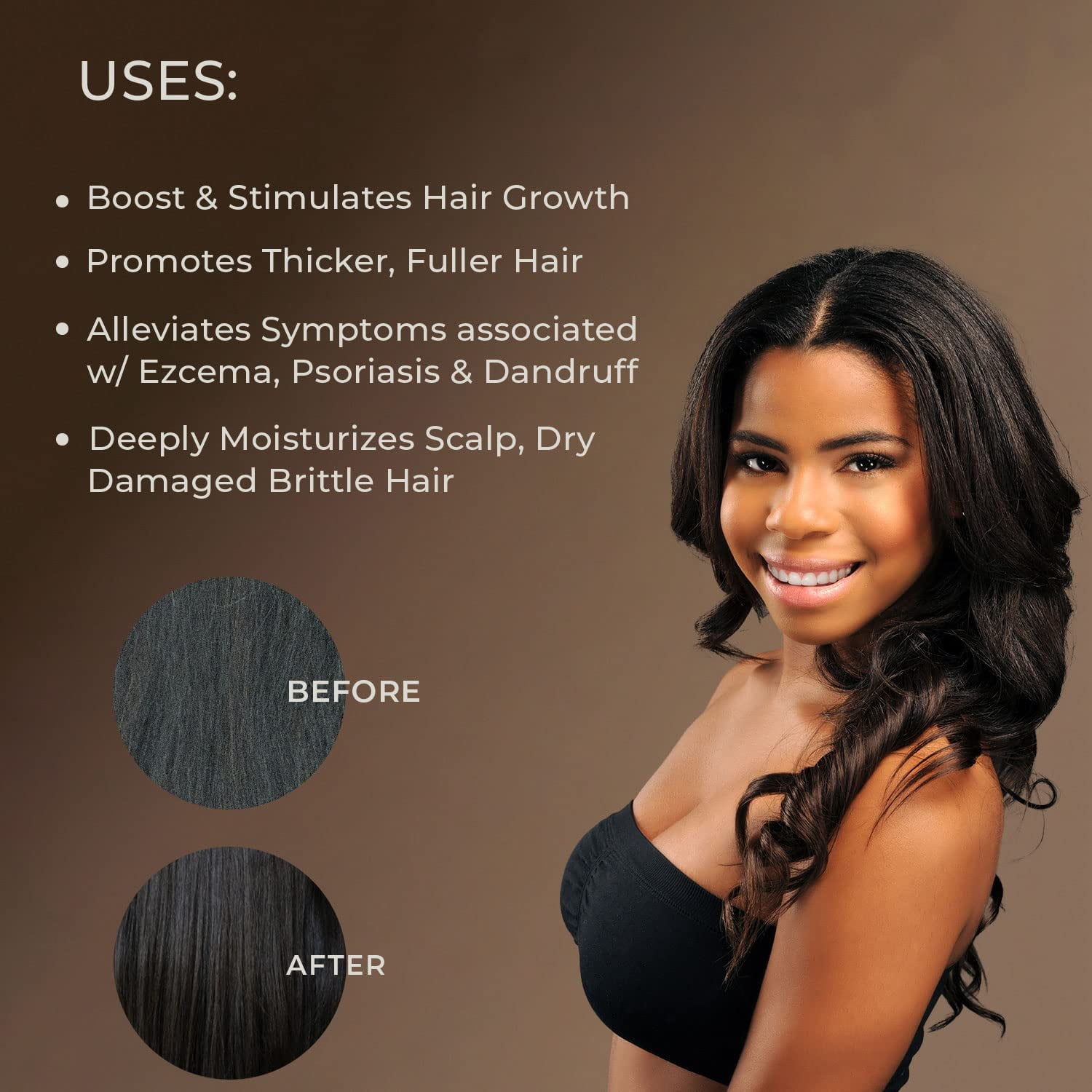 Bakson Sunny Arnica Hair Oil Review In Hindi | बैकसन सनी अर्निका हेयर ऑयल  इस्तेमाल करे By @DrArun - YouTube
