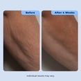thumbnail image 3 of Plexaderm Dual Action Repair Cream for Neck, Chest & Arms – Firming Cream with Retinol & Bakuchiol for Crepey Skin, Fine Lines & Wrinkles, 3 of 9