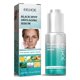 thumbnail image 1 of Suero reparador antiedad corrector de manchas oscuras. La piel queda inmediatamente hidratada, revitalizada y tonificada. Aclara y minimiza las líneas de expresión. Conservante: 30 ml de agua esencial, 1 of 5