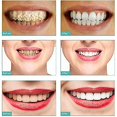 thumbnail image 5 of Teeth Cleaning Kit Dental Cleaner Tool, Rechargeable Plaque Remover For Teeth, 5 of 5