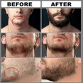 thumbnail image 5 of 5/8/9Pcs Men's Beard Care Kit, Deluxe Beard Grooming & Styling Kit includes Beard Growth Serum, Comb, Balm, Oil, Scissors, 5 of 5