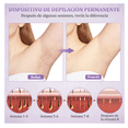 thumbnail image 3 of Depiladora Láser Corporal Lab.G Modo Frio color Violeta 127V, 3 of 5