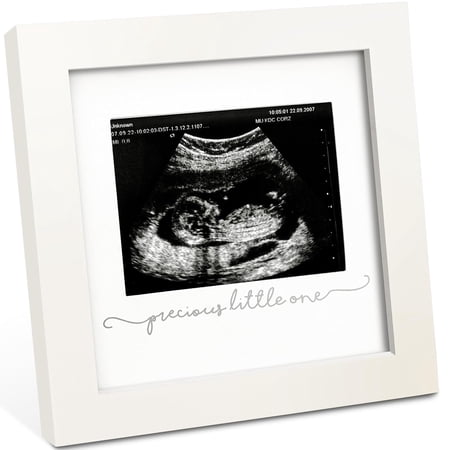 XIBUFE Baby Sonogram Picture Frame - Modern Ultrasound Picture Frames for Mom to Be,First Pregnancy Gifts for Expecting Mom & First Time Dad,Baby Gender Reveal Gifts (Alpine White)