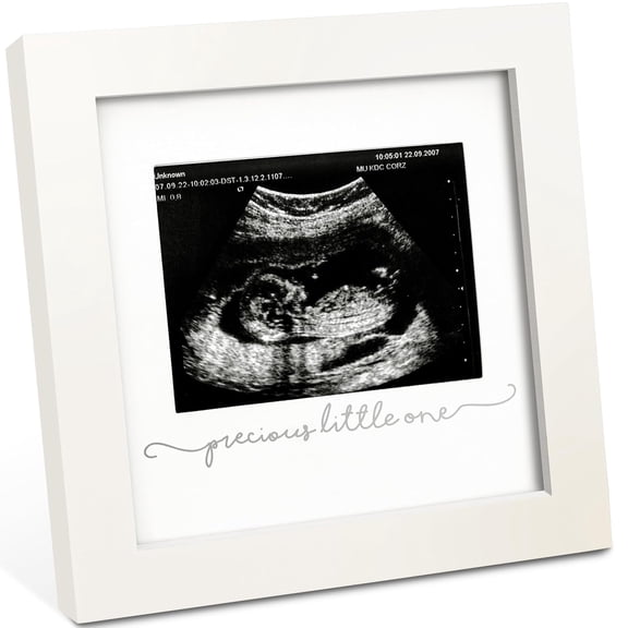 XIBUFE Baby Sonogram Picture Frame - Modern Ultrasound Picture Frames for Mom to Be,First Pregnancy Gifts for Expecting Mom & First Time Dad,Baby Gender Reveal Gifts (Alpine White)