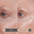 thumbnail image 3 of Consult Beaute Volumagen TRIO Skin Care Cream - 0.5 fl oz, 1.7 fl oz, 2 fl oz, 3 of 11