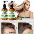 thumbnail image 5 of 3 in 1 Jamaican Black Castor Oil + Rosemary Oil + Batana oil (Shampoo and Conditioner Set), 5 of 7