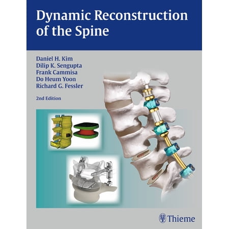 Dynamic Reconstruction of the Spine (Hardcover)