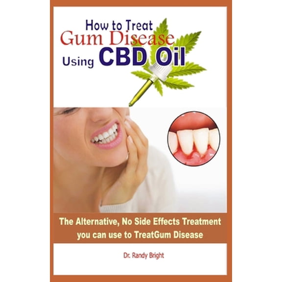 Pre-Owned How to Treat Gum Disease Using CBD oil: The Alternative No Side Effects Treatment you can use to Treat Gum Disease (Paperback) 170336905X 9781703369052