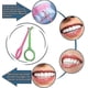 thumbnail image 5 of Herramienta de eliminación de alineadores Eliminación de dientes invisibles Alineadores masticables y kits de herramientas de eliminación Removedor de retenedores para aparatos ort, 5 of 5