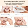 thumbnail image 2 of Blackhead Remover, 5 Pack Blackhead Extractor Professional Blackhead Remover Tools, Easy for Pimple Acne Blemish Removal - With Metal Case, 2 of 8