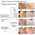 thumbnail image 2 of Crema para blanquear la piel con hidroquinona 30 g Hidratante facial anti puntos negros // kaili Sencillez, 2 of 2