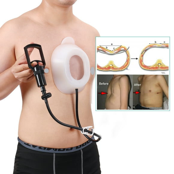 Child Pectus Excavatum Vacuum Bell -Kids Pectus Excavatum Orthosis Brace,Physical Correction,Washable,with Pressure Gauge
