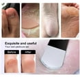 thumbnail image 6 of Professional Foot Callus Remover Tool Set Toe Manicure Pedicure Knife Cutterss S7L5, 6 of 6