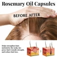 thumbnail image 6 of Hair Treatment Serum Oil Capsules, Rosemary Hair Repair Oil, Natural Essential Oil, Moisturizing Hair Serum,Strong Hair Roots，Scalp Treatment, Thickening Moisture, 30 Capsules, 6 of 10