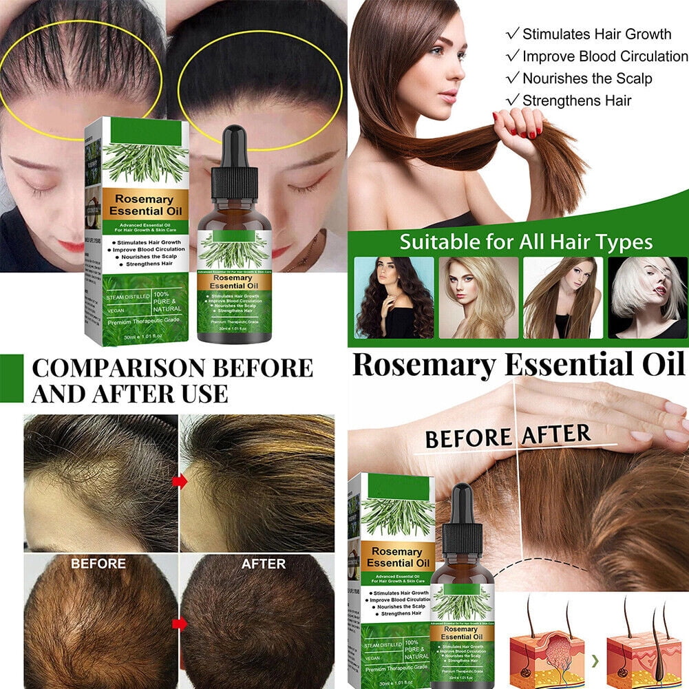 US 24 Pcs Rosemary Essential Oil Hair Growth 100 Pure Natural Therapeutic