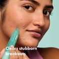 thumbnail image 4 of Gel para acné Hero Cosmetics Corrector de granos 10 ml, 4 of 9