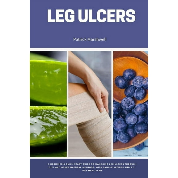 Leg Ulcers: A Beginner's Quick Start Guide to Managing Leg Ulcers Through Diet and Other Natural Methods, With Samp, (Paperback)