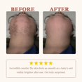 thumbnail image 6 of Facial Hair Removal Cream for Women   - Painless Depilatory Cream for  Upper Lip Chin & Cheeks with Spatula, 5-Minute At- Hair Remover for Pubic, 1.68 Fl Oz, 6 of 6