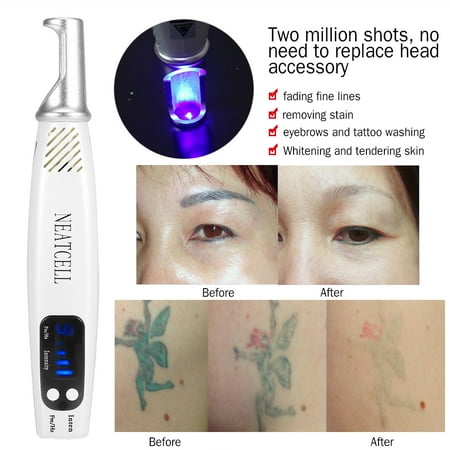 WALFRONT Spot Removal Laser Pen,Scar Removal Machine,Handheld Picosecond Laser Pen Tattoo Scar Freckle Removal Machine Skin Beauty (Best Tattoo Removal Machine)