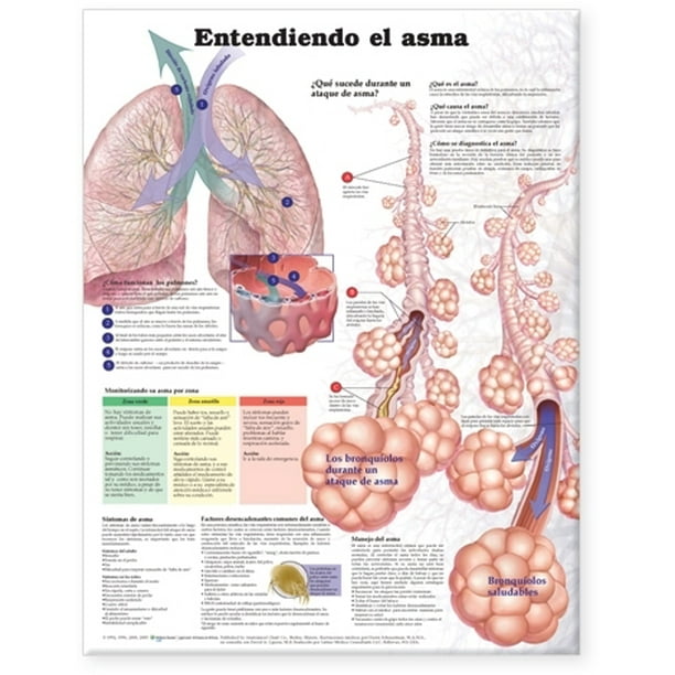 Understanding Asthma Anatomical Chart in Spanish (Entendiendo El Asma