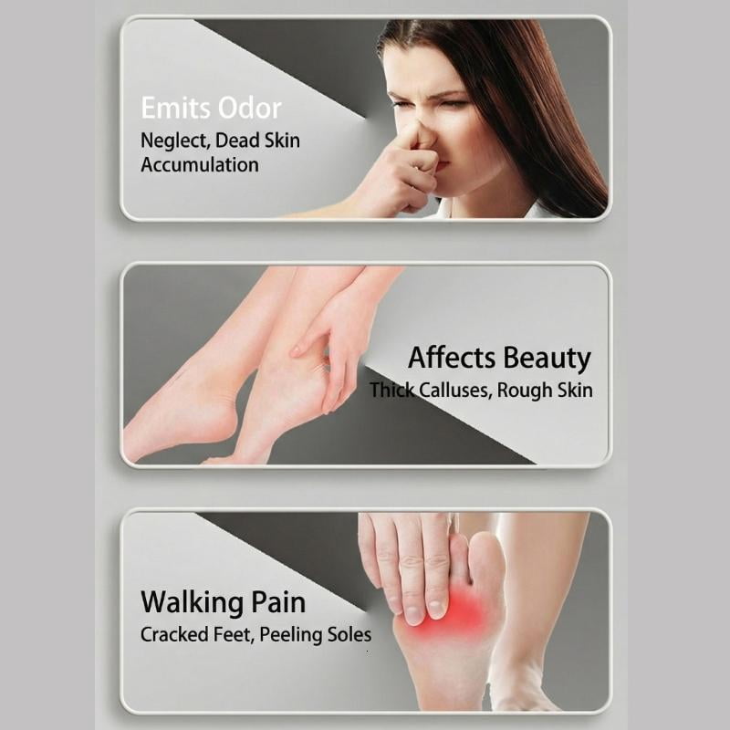 CEORPER Rechargeable Callus Remover With IPX5 Water Resistant Design And USB Power For Home Use