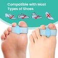 thumbnail image 3 of Welnove Bunion Corrector, Toe Separators with 2 Loops, Big Toe Spacer Suitable for Bunion and Overlap Toe (Pack of 12, Blue), 3 of 6