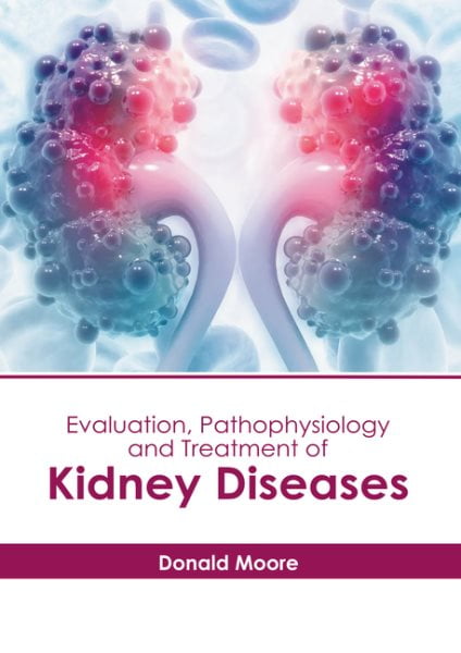 健康・医学 Diagnostic Pathology Kidney Diseases Diagnostic Pathology: Kidney Diseases: 9780443107177