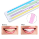 thumbnail image 4 of Kit de Tiras para Pulido Dental, Pulidor de Dientes, Lijado, Pulido Profundo de Dientes, Herramienta de Limpieza Bucal, 120 Piezas, Multicolor, 4 of 5