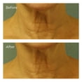 thumbnail image 4 of Protector solar Perricone MD Cold Plasma Plus+ para cuello y pecho SPF 25 Perricone MD Perricone MD, 4 of 5