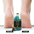 thumbnail image 5 of FOOTSPA - Pedi Spray Antiseptic, Mint & Eucalyptus - Effective Foot Care - 128 Ounces, 5 of 7