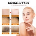 thumbnail image 6 of KeirineCC Remove Dark Soap Bar, Body Cleansing Bar Soap, Handmade Soap Bar for Face & Body, Bar Soap Daily Silk for Dry Skin, Women & Men - All Skin Types - Bathroom Essentials, 6 of 7